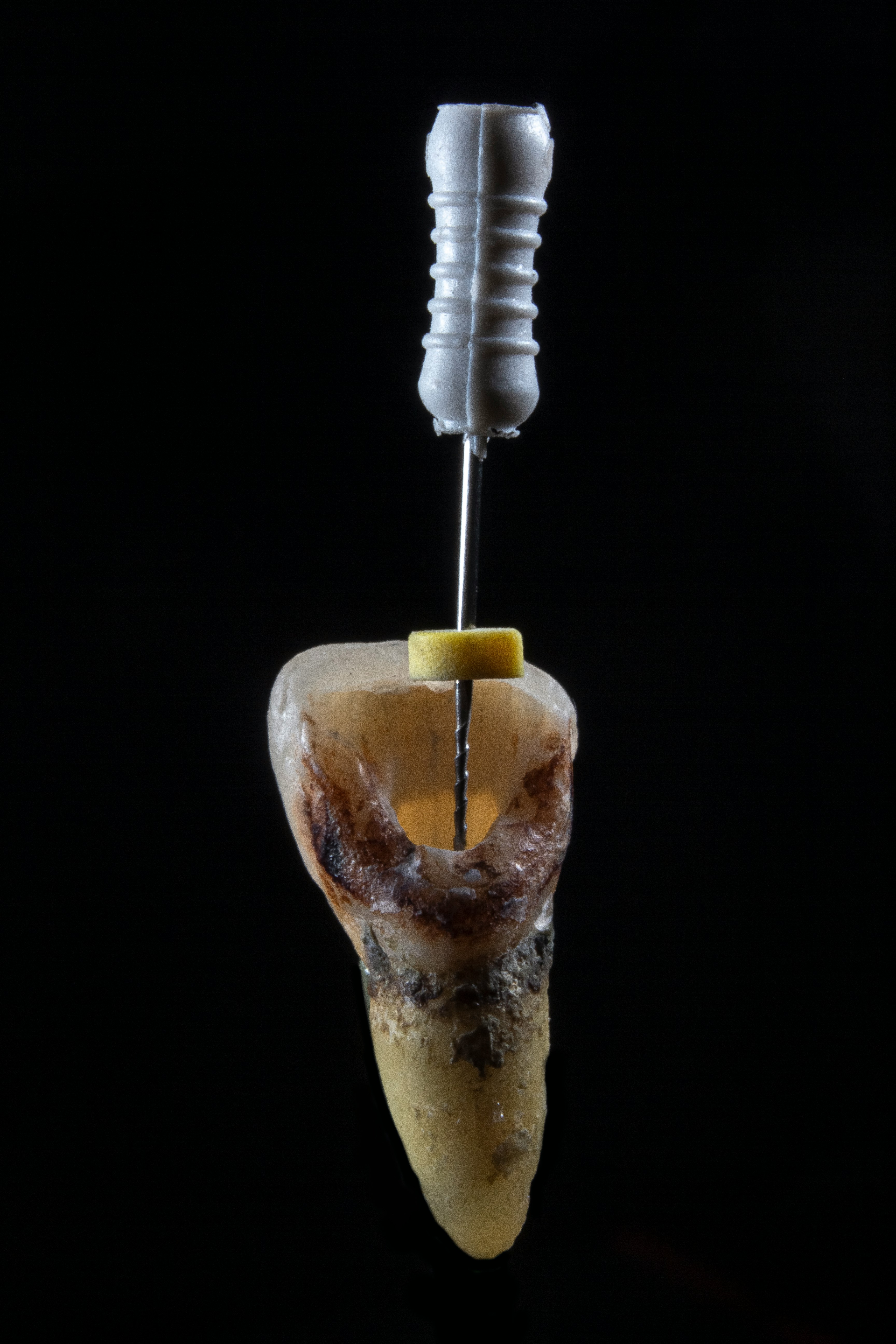 Endodoncia
