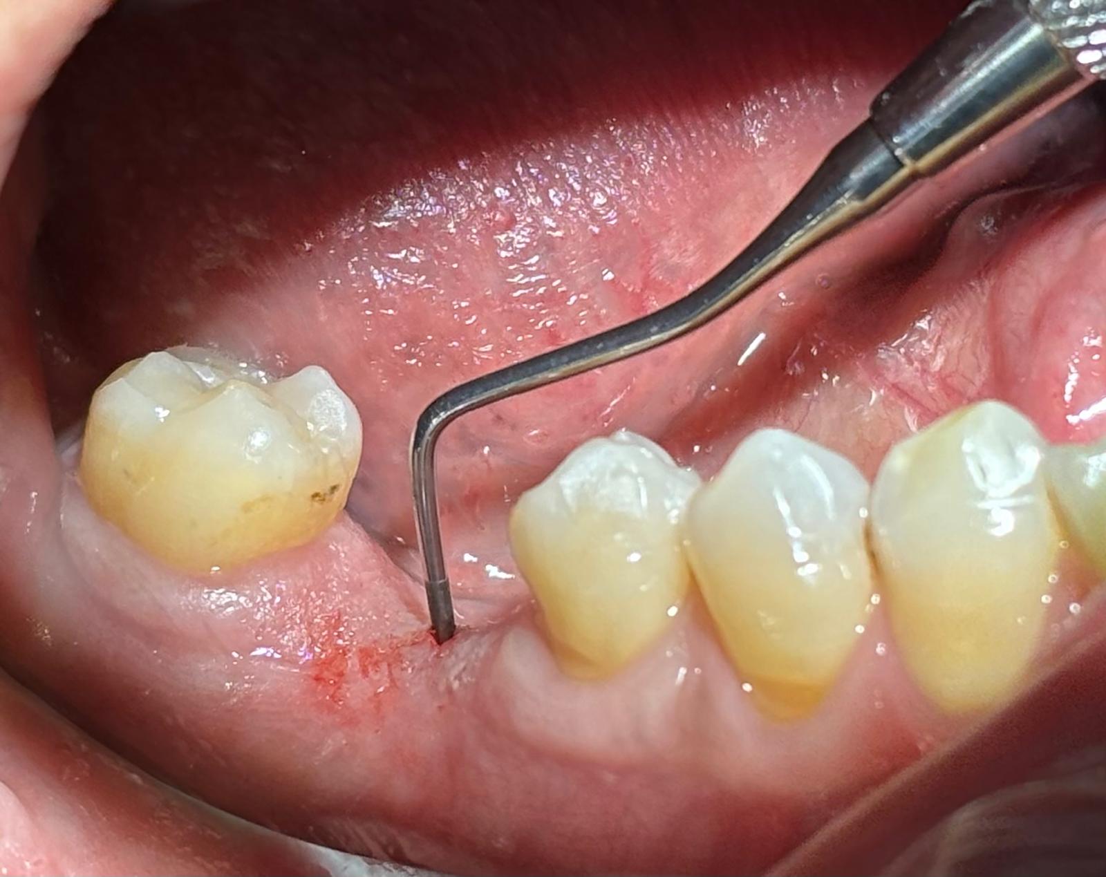 Anestesia y sedación