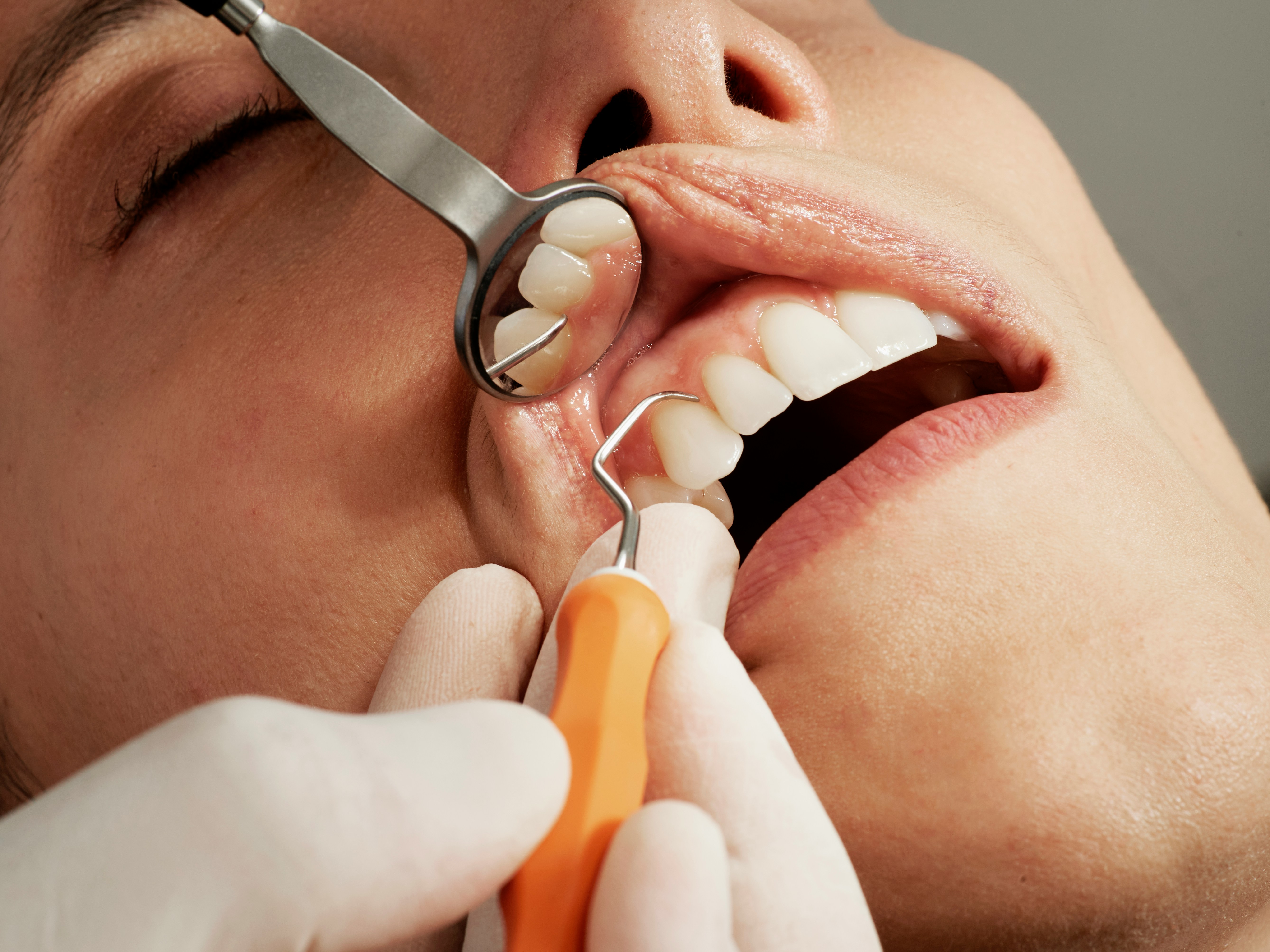 Periodoncia